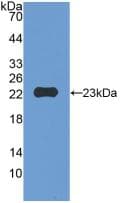 MMP12 Antibody (aa294-473)