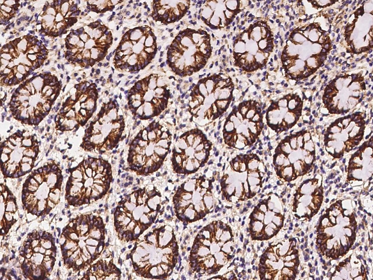 CLDN7 / Claudin 7 Antibody