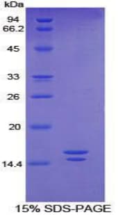 Human VIP Protein (Recombinant His)