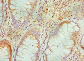 TGFBI Antibody (aa30-250)