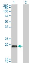 Monoclonal Mouse anti-Human CSRP3 Antibody (clone 6D2, IF, WB)
