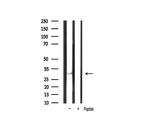 CCND1 / Cyclin D1 Antibody