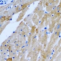 Polyclonal Rabbit anti-Human KIAA0153 / TTLL12 Antibody (IHC, WB)