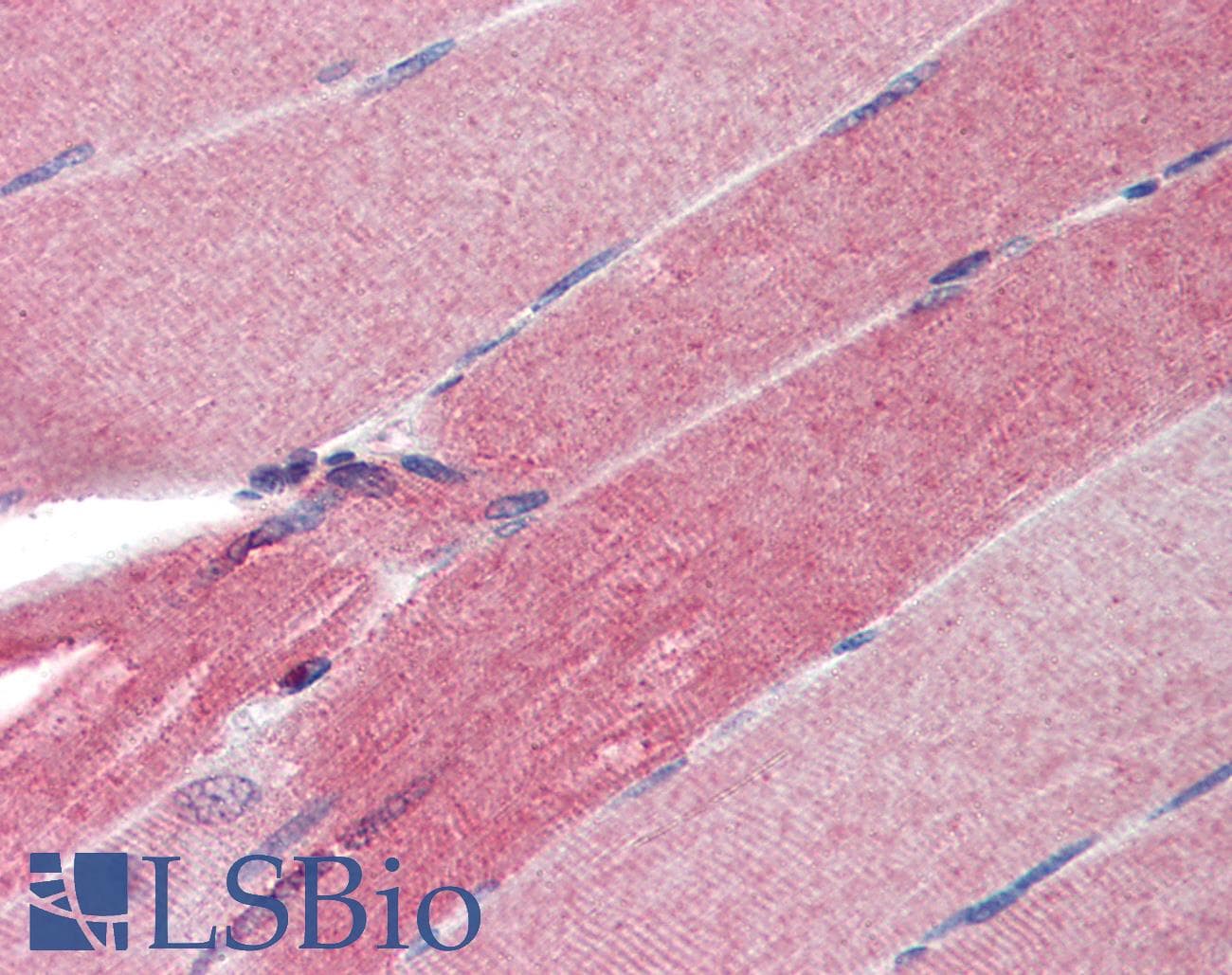 Polyclonal Rabbit anti-Human SLIM / FHL1 Antibody (aa51-100, IHC, WB)