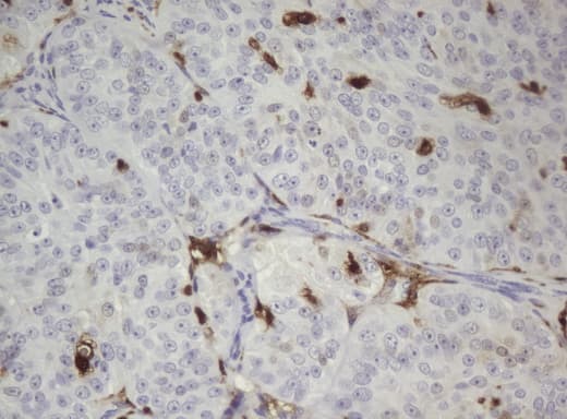 TP / Thymidine Phosphorylase Antibody (aa311-482, clone UMAB97)
