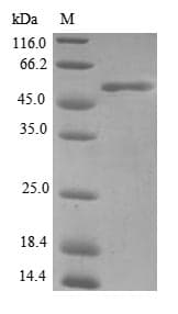 Human FHL3 Protein (Recombinant GST, N-terminus)