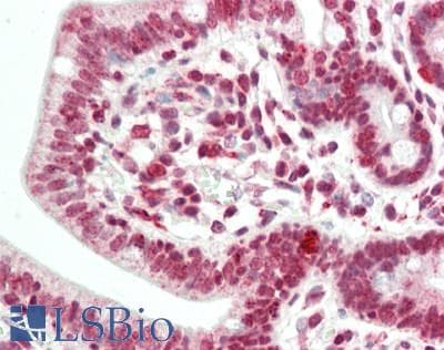 IHC-plus™ MBD2 Antibody (aa361-411)
