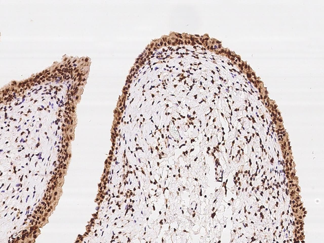 ARID1B / BAF250B Antibody