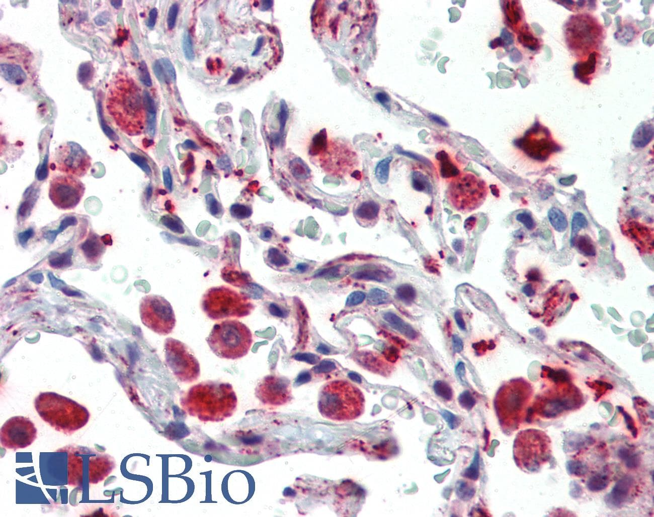 BCL6 Antibody (Internal)