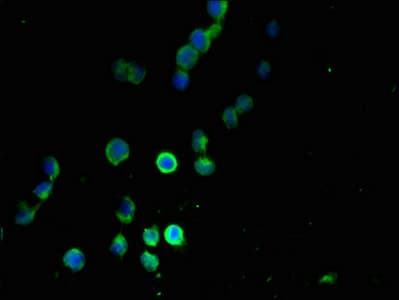 Polyclonal Rabbit anti-Human MANBAL Antibody