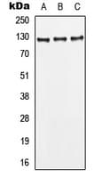 Polyclonal Rabbit anti-Human LEPR / Leptin Receptor Antibody (Internal, WB)