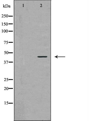 ATXN3 / JOS Antibody