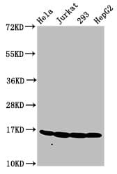 Polyclonal Rabbit anti-Human HIST1H3A Antibody (IHC, WB)