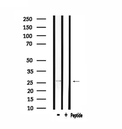 RNF125 / TRAC-1 Antibody