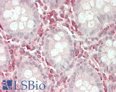 IHC-plus™ Polyclonal Rabbit anti-Human RPS3 / Ribosomal Protein S3 Antibody (IHC, WB)