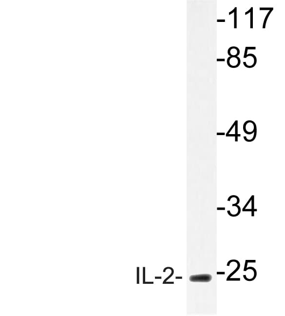 IL2 Antibody (aa16-65)
