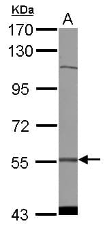 CDADC1 Antibody