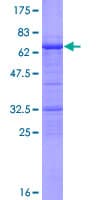 Human CCNY / Cyclin Y Protein (Recombinant GST)