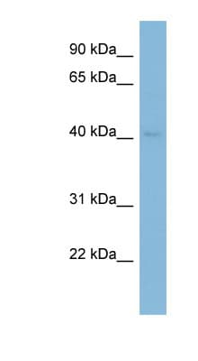 Polyclonal Rabbit anti-Human GRAB / RAB3IL1 Antibody (aa287-336, WB)