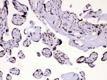 HNRPA1 / HnRNP A1 Antibody