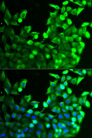 Polyclonal Rabbit anti-Human FGFR2 / FGF Receptor 2 Antibody (IHC, IF, WB)