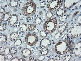 CATIP / C2orf62 Antibody (clone OTI4B4)