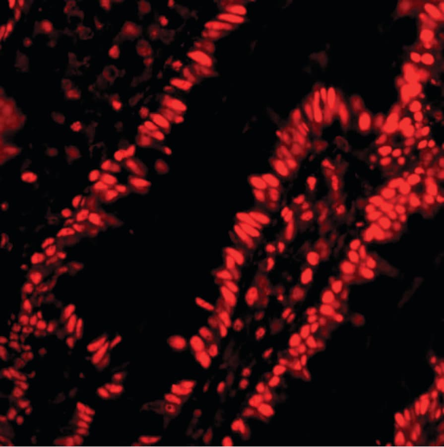 IHC-plus™ PHAP1 / ANP32A Antibody