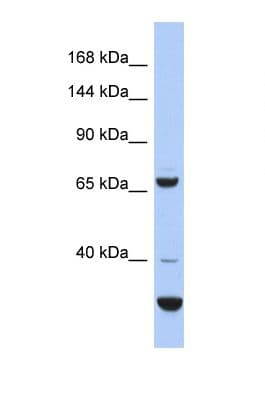 Polyclonal Rabbit anti-Human SRBD1 Antibody (aa420-469, WB)