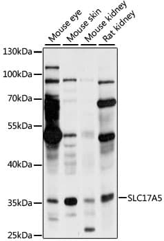 SLC17A5 Antibody