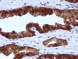 TIP48 / RUVBL2 Antibody (aa113-370, clone OTI1H10, Carrier-free)