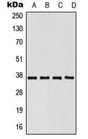 HnRNP-E1 / PCBP1 Antibody (N-Terminus)
