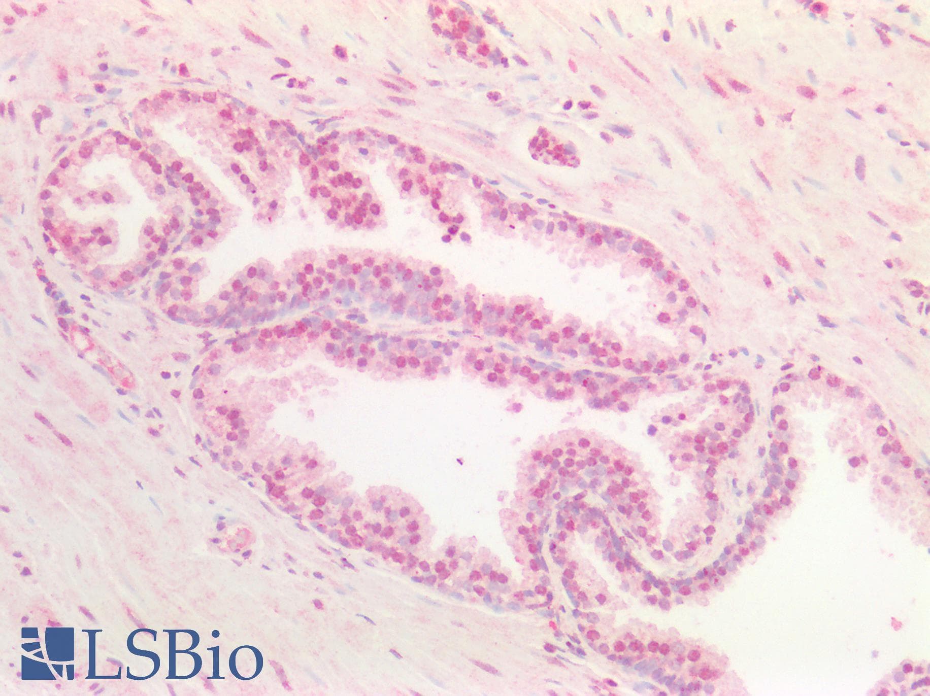 PathPlus™ Polyclonal Goat anti-Human SOX9 Antibody (aa248-259, IHC)