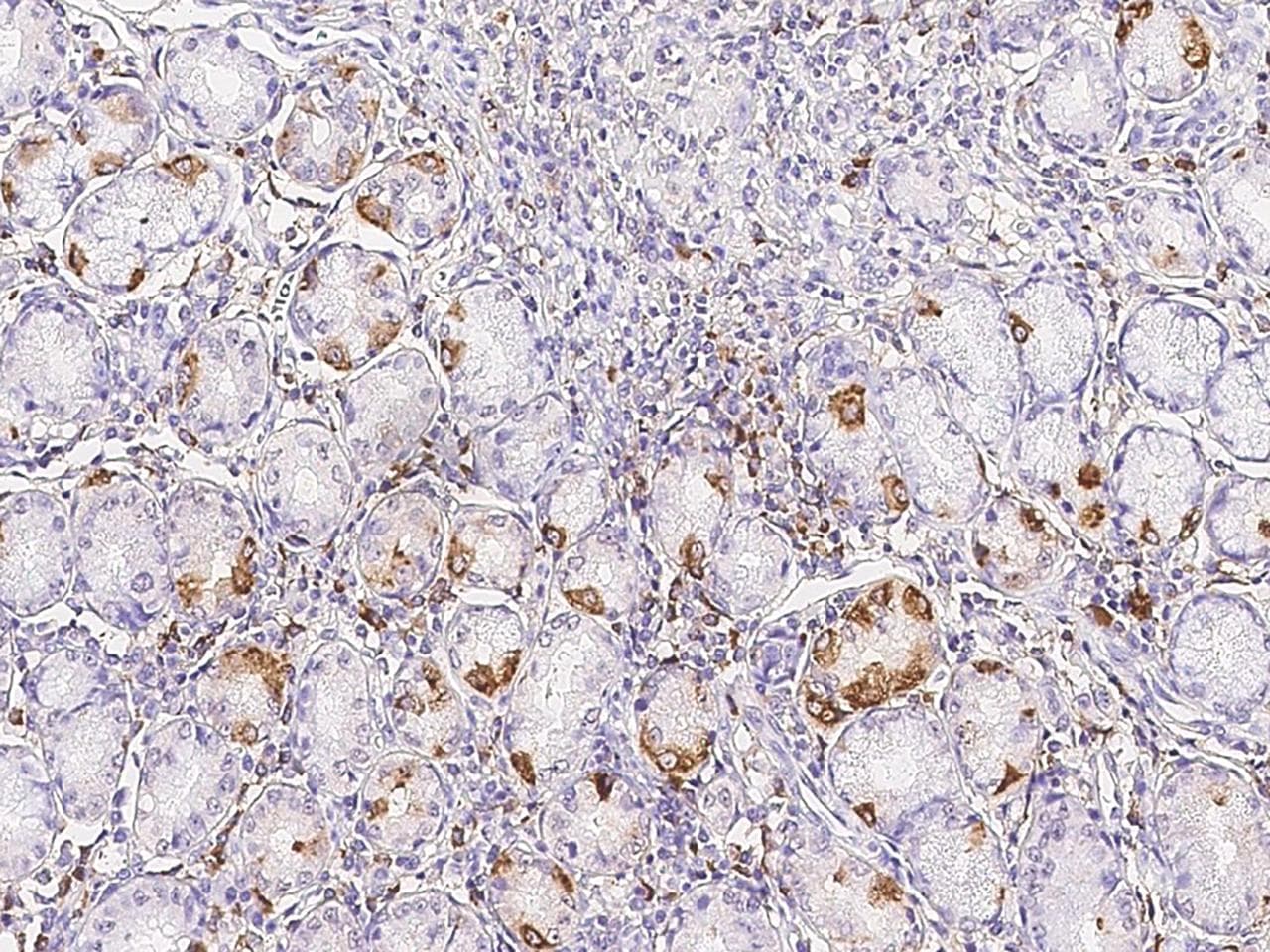 GIF / Intrinsic Factor Antibody (Preservative Free)