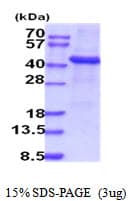 Human TPST1 Protein (Recombinant His)