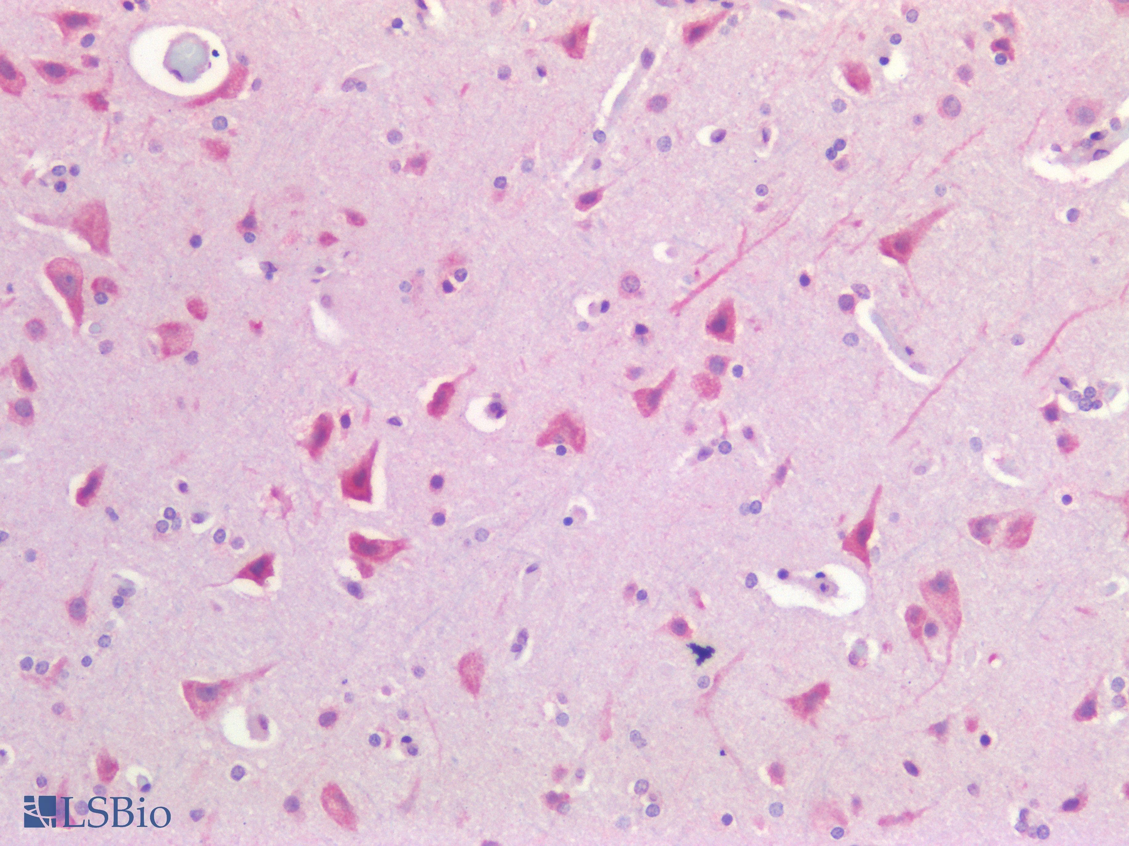 PathPlus™ USP19 Antibody