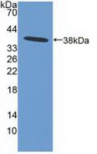 NFKBIB / IKB Beta / IKBB Antibody (aa85-332)