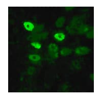Polyclonal Rabbit anti-Influenza Virus Influenza A Virus Nucleoprotein Antibody (aa428-441, IHC)