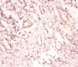 Polyclonal Rabbit anti-Human SNRPA / U1A Antibody (IHC, WB)