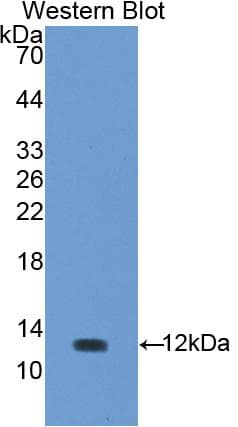 UCN / Urocortin Antibody (aa31-121)