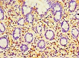 Polyclonal Rabbit anti-Human EWSR1 / EWS Antibody (aa1-300, IHC)