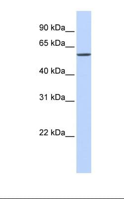 SLC7A1 / CAT1 Antibody (aa201-250)