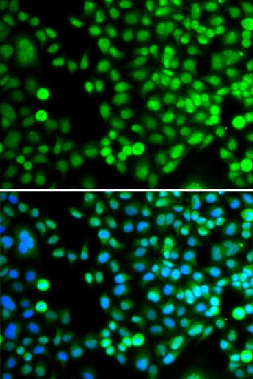 BCAS3 Antibody