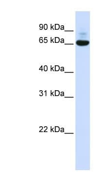 CNOT4 / CLONE243 Antibody (aa36-85)