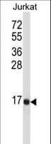 IHC-plus™ TAC3 / Tachykinin Antibody (aa54-83)