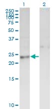 Monoclonal Mouse anti-Human Thymidylate Kinase Antibody (clone 2C2, WB)