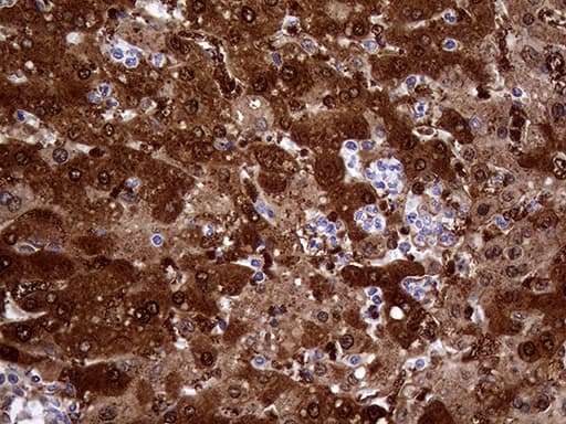 CBR / CBR1 Antibody (clone OTI4B4)