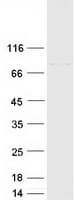 Human CSTF3 Protein (Recombinant Myc-DDK (Flag))