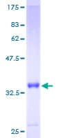 Human S100A6 / Calcyclin Protein (Recombinant GST)