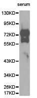 Polyclonal Rabbit anti-Human VTN / Vitronectin Antibody (IHC, WB)