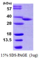 Human HSD17B8 / RING2 Protein (Recombinant His)